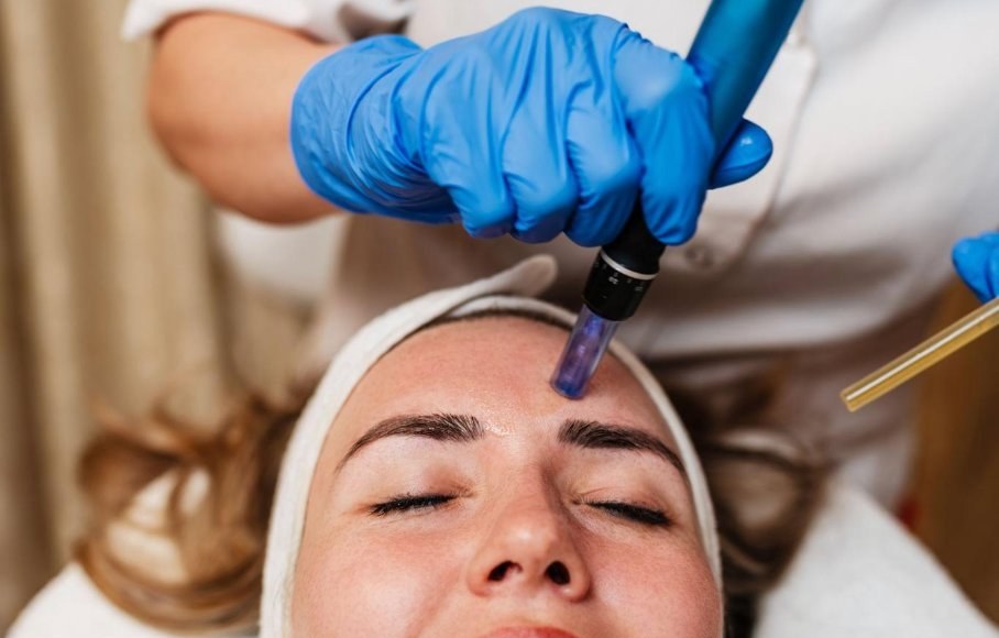 SkinPen® Precision Elite - Medicínsky microneedling SkinPen® Precision Elite - Medicínsky microneedling
