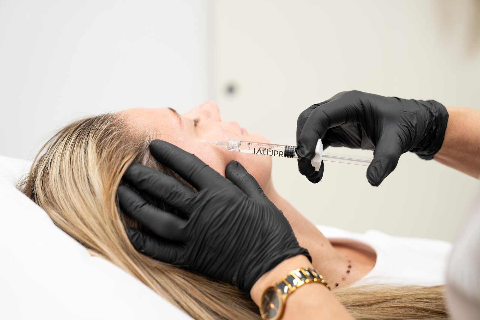 Aplikácia biorevitalizácie Jalupro do pleti klientky v SK Clinic
